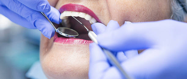 Best Chipped Tooth Repair Near Me  in Pennville, PA